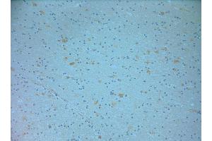 IHC on paraffin sections of human brain tissue using Goat antibody to NOS1: . (NOS1 anticorps  (C-Term))