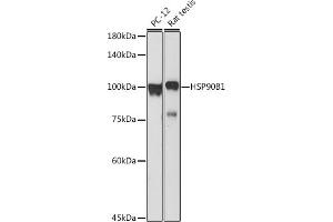 Western blot analysis of extracts of various cell lines, using HSP90B1 antibody (ABIN6130434, ABIN6142031, ABIN6142033 and ABIN7101795) at 1:1000 dilution.
