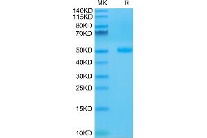 SDS-PAGE (SDS) image for Cytotoxic T-Lymphocyte-Associated Protein 4 (CTLA4) (AA 36-161) protein (Fc Tag) (ABIN7274436)