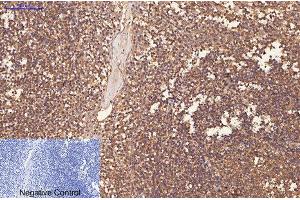 Immunohistochemistry (IHC) image for anti-CD1a (CD1a) antibody (ABIN5962370) (CD1a anticorps)