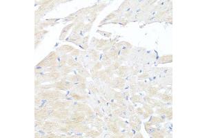 Immunohistochemistry of paraffin-embedded mouse heart using FGFR2 antibody.