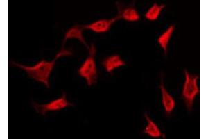 ABIN6269289 staining NIH-3T3 by IF/ICC. (BCAR1 anticorps  (Internal Region))