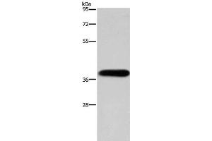 Western Blot analysis of HepG2 cell using PITX2 Polyclonal Antibody at dilution of 1:200 (PITX2 anticorps)