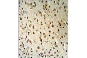 TARSL2 Antibody (C-term) (R) IHC analysis in formalin fixed and paraffin embedded human brain tissue followed by peroxidase conjugation of the secondary antibody and DAB staining. (TARSL2 anticorps  (C-Term))