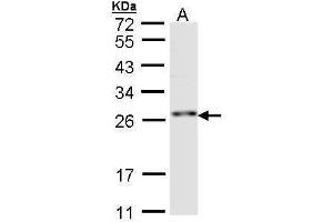 WB Image Sample (30 ug of whole cell lysate) A:Hep G2 , 12 % SDS PAGE antibody diluted at 1:1000 (RNF114 anticorps)