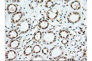 Image no. 4 for anti-Ubiquitin Specific Peptidase 5 (USP5) antibody (ABIN1501693)