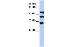 PPP1R13B antibody used at 1 ug/ml to detect target protein.
