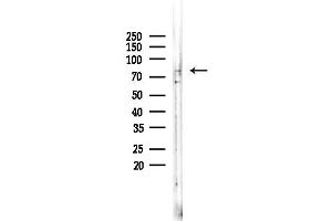 anti-Interleukin 1 Receptor Accessory Protein-Like 2 (IL1RAPL2) (Internal Region) antibody