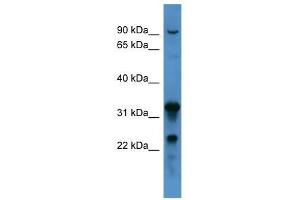 Western Blot showing F8 antibody used at a concentration of 1-2 ug/ml to detect its target protein. (Factor VIII anticorps  (C-Term))