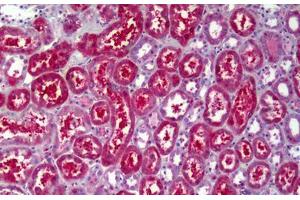 Anti-ATP6V1B2 antibody IHC staining of human kidney, tubules.