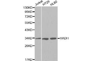 Western blot analysis of extracts of various cell lines, using HADH antibody (ABIN5970434) at 1/1000 dilution. (HADH anticorps)