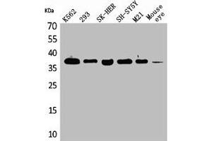 Western Blot analysis of K562 293 SK-HEP-1 SHSY5Y M21 mouse eye cells using RRP7A Polyclonal Antibody