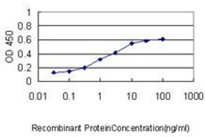 Detection limit for recombinant GST tagged PIM1 is approximately 0. (PIM1 anticorps  (AA 1-100))