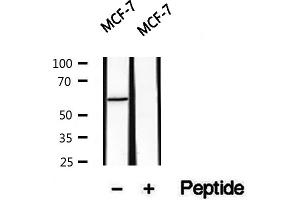 Western blot analysis of extracts of MCF7 cells, using PKLR antibody. (PKLR anticorps  (Internal Region))