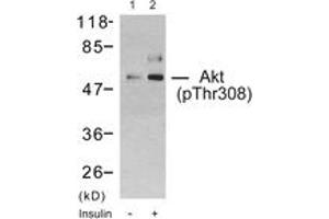 Western blot analysis of extracts from 293 cells treated with Insulin, using Akt (Phospho-Thr308) Antibody. (AKT1 anticorps  (pThr308))