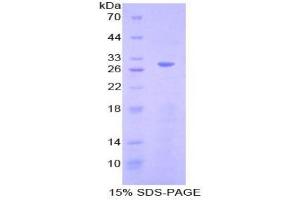 SDS-PAGE analysis of Mouse Cyclin D2 Protein. (Cyclin D2 Protein (CCND2))
