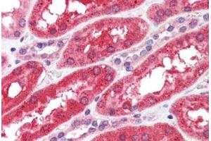 Human Kidney (formalin-fixed, paraffin-embedded) stained with FGFR4 antibody ABIN462303 followed by biotinylated anti-mouse IgG secondary antibody ABIN481714, alkaline phosphatase-streptavidin and chromogen. (FGFR4 anticorps)