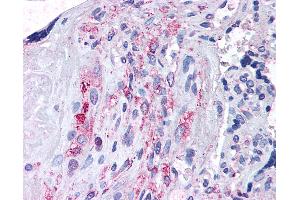 Anti-ADAMTS5 antibody IHC of human placenta.