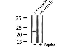 Western blot analysis of extracts from rat muscle, using CD3E Antibody. (CD3 epsilon anticorps  (C-Term))