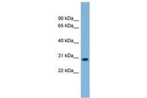 Image no. 1 for anti-Chromosome 11 Open Reading Frame 57 (C11orf57) (AA 107-156) antibody (ABIN6744127) (C11orf57 anticorps  (AA 107-156))