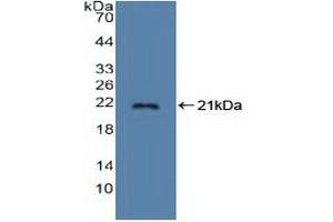 Detection of Recombinant STMN1, Human using Polyclonal Antibody to Stathmin 1 (STMN1) (Stathmin 1 anticorps  (AA 2-149))