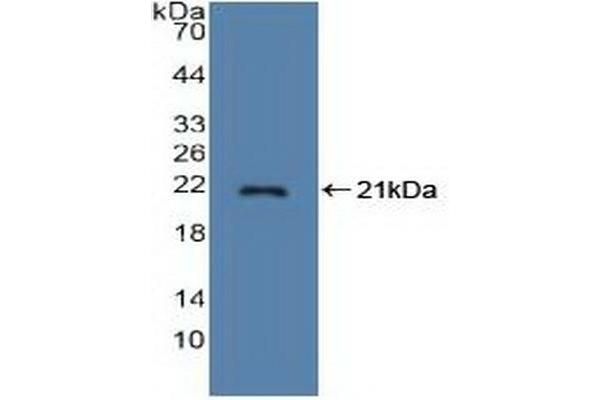 Stathmin 1 anticorps  (AA 2-149)