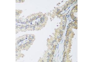 Immunohistochemistry of paraffin-embedded human prostate using IGFBP4 antibody at dilution of 1:100 (40x lens). (IGFBP4 anticorps)