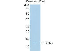Detection of Recombinant CNP, Human using Polyclonal Antibody to C-Type Natriuretic Peptide (CNP) (NPPC anticorps  (AA 33-125))