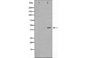 Western blot analysis on COLO205 cell lysate using MAPK3 Antibody,The lane on the left is treated with the antigen-specific peptide. (MAPKAP Kinase 3 anticorps  (C-Term))
