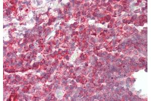 Rabbit Anti-PFN1 antibody  Formalin Fixed Paraffin Embedded Tissue: Human Tonsil Primary antibody Concentration: 1:100 Secondary Antibody: Donkey anti-Rabbit-Cy3 Secondary Antibody Concentration: 1:200 Magnification: 20x Exposure Time: 0. (PFN1 anticorps  (N-Term))