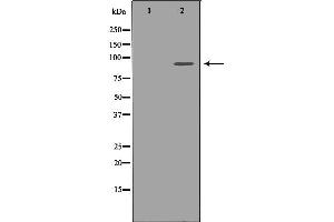 Western blot analysis of extracts of Jurkat, using FGFR1 antibody. (FGFR1 anticorps  (C-Term))