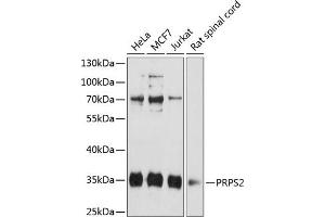 Western blot analysis of extracts of various cell lines, using PRPS2 antibody (ABIN6132522, ABIN6146273, ABIN6146275 and ABIN6216353) at 1:3000 dilution. (PRPS2 anticorps  (AA 1-240))