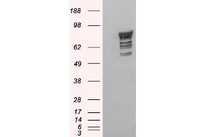 Western Blotting (WB) image for anti-phosphodiesterase 4D, cAMP-Specific (PDE4D) antibody (ABIN5930195) (PDE4D anticorps)