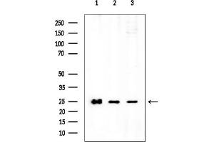 anti-LSM1 Homolog, U6 Small Nuclear RNA Associated (LSM1) (N-Term) antibody