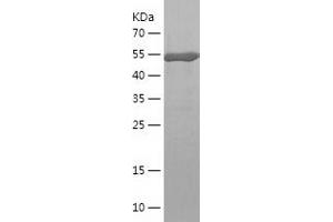 Western Blotting (WB) image for Chloride Intracellular Channel 1 (CLIC1) (AA 1-241) protein (His-IF2DI Tag) (ABIN7122351)