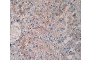 DAB staining on IHC-P; Samples: Human Liver Tissue (TPSAB1 anticorps  (AA 161-262))