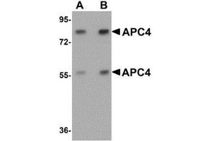 Western blot analysis of APC4 in mouse liver tissue lysate with APC4 antibody at (A) 1 and (B) 2 μg/ml.