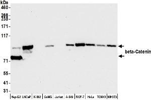 Western Blotting (WB) image for anti-Catenin, beta (CATNB) (AA 725-775) antibody (ABIN7454021)