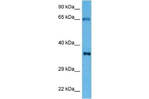 Host:  Mouse  Target Name:  TNNT2  Sample Tissue:  Mouse Skeletal Muscle  Antibody Dilution:  1ug/ml (Cardiac Troponin T2 anticorps  (N-Term))