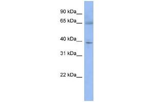 WB Suggested Anti-ZNF302 Antibody Titration:  0.