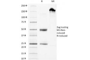 SDS-PAGE Analysis of Purified, BSA-Free LAMP3 Antibody (clone LAMP3/968).