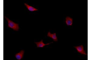 ABIN6259942 and ABIN6277949 staining HepG2 by IF/ICC. (ANO1 anticorps  (Internal Region))