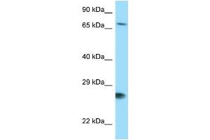 WB Suggested Anti-BAG1 Antibody Titration: 1. (BAG1 anticorps  (N-Term))