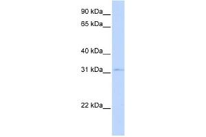 WB Suggested Anti-NKX3-1 Antibody Titration:  0. (NKX3-1 anticorps  (Middle Region))