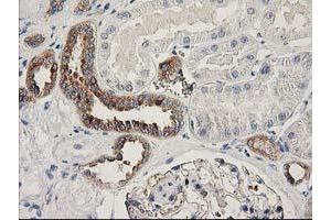 Image no. 7 for anti-Breast Cancer Anti-Estrogen Resistance 1 (BCAR1) antibody (ABIN1496834)