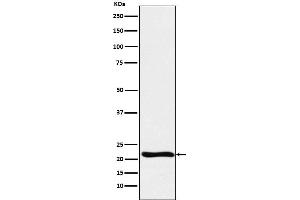 Western blot analysis of GLO1 expression in Raji cell lysate.