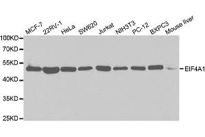 Western Blotting (WB) image for anti-Eukaryotic Translation Initiation Factor 4A2 (EIF4A2) antibody (ABIN1876482)