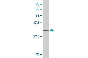 Western Blot detection against Immunogen (36. (PKNOX1 anticorps  (AA 2-100))