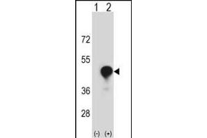 Western blot analysis of CD1C (arrow) using rabbit polyclonal CD1C Antibody (C-term) (ABIN657353 and ABIN2837919). (CD1c anticorps  (C-Term))