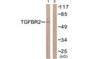 Western blot analysis of extracts from NIH-3T3 cells, using TGF beta Receptor II (Ab-250) Antibody. (TGFBR2 anticorps  (AA 191-240))
